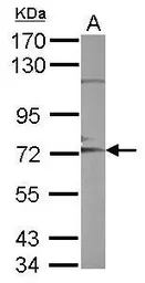 Anti-ADAM10 antibody [N1N2], N-term used in Western Blot (WB). GTX111347