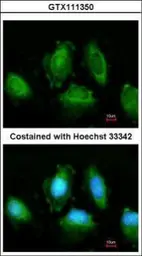 Anti-IKK epsilon antibody [C2C3], C-term used in Immunocytochemistry/ Immunofluorescence (ICC/IF). GTX111350
