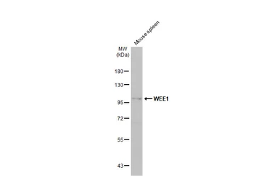 Anti-WEE1 antibody [N3C2], Internal used in Western Blot (WB). GTX111392