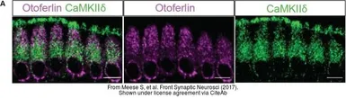 Anti-CaMKII delta antibody used in  (). GTX111401