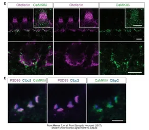 Anti-CaMKII delta antibody used in  (). GTX111401