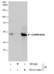 Anti-CaMKII delta antibody used in Immunoprecipitation (IP). GTX111401