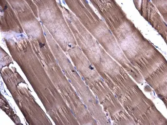 Anti-CaMKII delta antibody used in IHC (Paraffin sections) (IHC-P). GTX111401