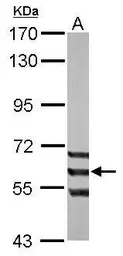 Anti-ADCK1 antibody [N1N3] used in Western Blot (WB). GTX111437