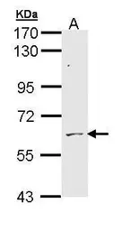 Anti-ADCK1 antibody [N1N3] used in Western Blot (WB). GTX111437