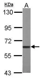 Anti-MPP2 antibody [C1C3] used in Western Blot (WB). GTX111438