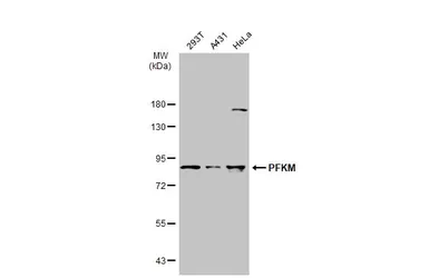 Anti-PFKM antibody [N1N2-2], N-term used in Western Blot (WB). GTX111461