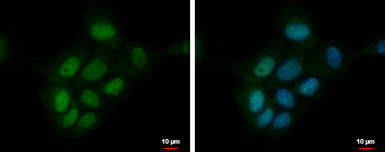 Anti-PRKCBP1 antibody used in Immunocytochemistry/ Immunofluorescence (ICC/IF). GTX111462
