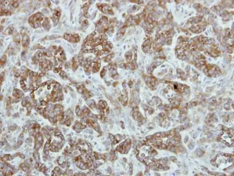 Anti-TRIP6 antibody [N3C3] used in IHC (Paraffin sections) (IHC-P). GTX111504