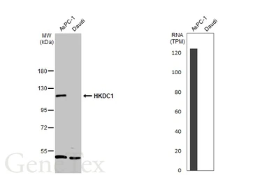 Anti-HKDC1 antibody used in Western Blot (WB). GTX111506