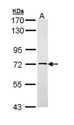 Anti-TXNDC3 antibody [N3C3] used in Western Blot (WB). GTX111512