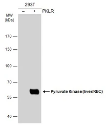 Anti-Pyruvate Kinase (liver/RBC) antibody used in Western Blot (WB). GTX111536