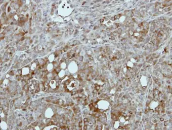 Anti-Pyruvate Kinase (liver/RBC) antibody used in IHC (Paraffin sections) (IHC-P). GTX111536