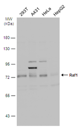 Anti-Raf1 antibody [N1C1-2] used in Western Blot (WB). GTX111588