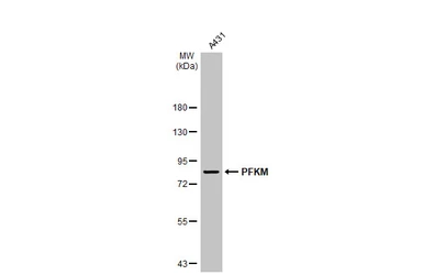 Anti-PFKM antibody [C1C3] used in Western Blot (WB). GTX111597
