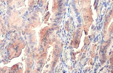 Anti-PKM antibody used in IHC (Paraffin sections) (IHC-P). GTX111604