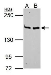 Anti-MSH6 antibody [C1C2], Internal used in Western Blot (WB). GTX111661