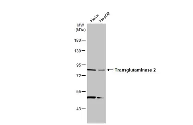 Anti-Transglutaminase 2 antibody [N1N3] used in Western Blot (WB). GTX111701