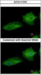 Anti-Transglutaminase 2 antibody [N1N3] used in Immunocytochemistry/ Immunofluorescence (ICC/IF). GTX111701