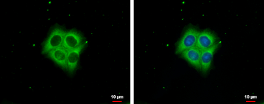 Anti-Ezrin antibody [N2C2], Internal used in Immunocytochemistry/ Immunofluorescence (ICC/IF). GTX111709
