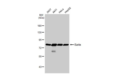 Anti-Ezrin antibody [N2C2], Internal used in Western Blot (WB). GTX111709
