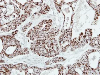 Anti-Adenylate kinase 2 antibody [N1C2] used in IHC (Paraffin sections) (IHC-P). GTX111726