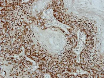 Anti-Adenylate kinase 2 antibody [N1C3-2] used in IHC (Paraffin sections) (IHC-P). GTX111737