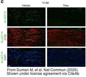 Anti-S100 beta antibody [SH-B4] used in IHC (Frozen sections) (IHC-Fr). GTX11179