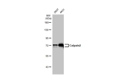 Anti-Calpain 2 antibody [N2C1-2], Internal used in Western Blot (WB). GTX111809