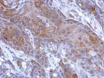 Anti-Calpain 2 antibody [N2C1-2], Internal used in IHC (Paraffin sections) (IHC-P). GTX111809