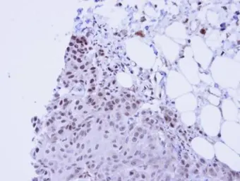Anti-SSRP1 antibody [N1N3] used in IHC (Paraffin sections) (IHC-P). GTX111816