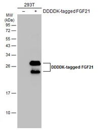 Anti-FGF21 antibody [N3C3] used in Western Blot (WB). GTX111877