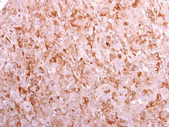 Anti-CD3 gamma antibody [C1C3] used in IHC (Paraffin sections) (IHC-P). GTX111878