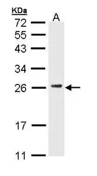 Anti-CD3 gamma antibody [C1C3] used in Western Blot (WB). GTX111878