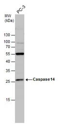 Anti-Caspase 14 antibody used in Western Blot (WB). GTX111888