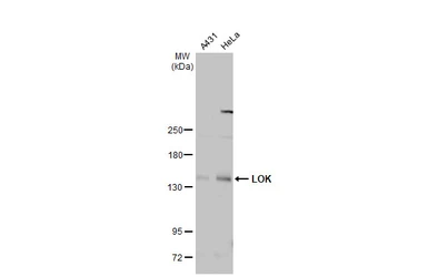Anti-LOK antibody [N1N2], N-term used in Western Blot (WB). GTX111951