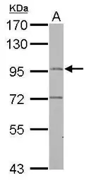 Anti-FLJ32786 antibody [N2C1], Internal used in Western Blot (WB). GTX111979