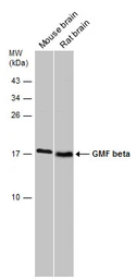 Anti-GMF beta antibody [N1C3] used in Western Blot (WB). GTX111991