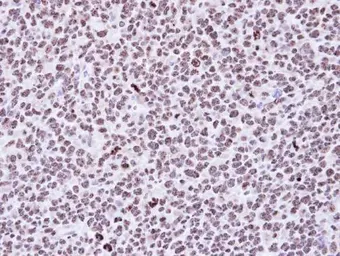 Anti-p53DINP1 antibody [N1N2], N-term used in IHC (Paraffin sections) (IHC-P). GTX112066