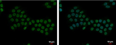 Anti-Apoptosis-enhancing nuclease antibody [C2C3], C-term used in Immunocytochemistry/ Immunofluorescence (ICC/IF). GTX112086