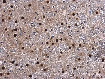 Anti-CA150 antibody used in IHC (Paraffin sections) (IHC-P). GTX112099