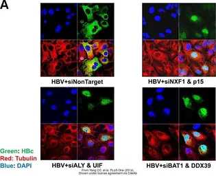Anti-alpha Tubulin antibody used in Immunocytochemistry/ Immunofluorescence (ICC/IF). GTX112141