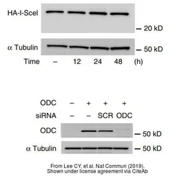 Anti-alpha Tubulin antibody used in Western Blot (WB). GTX112141