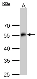 Anti-alpha Tubulin antibody used in Western Blot (WB). GTX112141