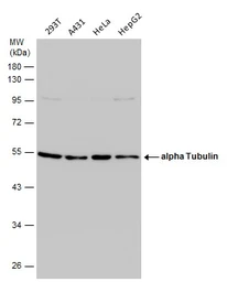 Anti-alpha Tubulin antibody used in Western Blot (WB). GTX112141