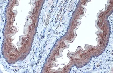 Anti-alpha Tubulin antibody used in IHC (Paraffin sections) (IHC-P). GTX112141