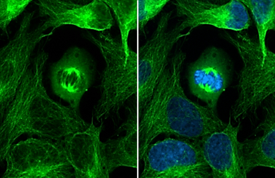 Anti-alpha Tubulin antibody used in Immunocytochemistry/ Immunofluorescence (ICC/IF). GTX112141