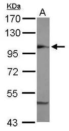 Anti-COPB antibody used in Western Blot (WB). GTX112164