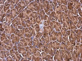 Anti-RPL4 antibody used in IHC (Paraffin sections) (IHC-P). GTX112184