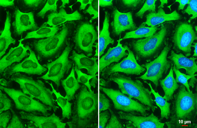 Anti-G3BP1 antibody used in Immunocytochemistry/ Immunofluorescence (ICC/IF). GTX112191